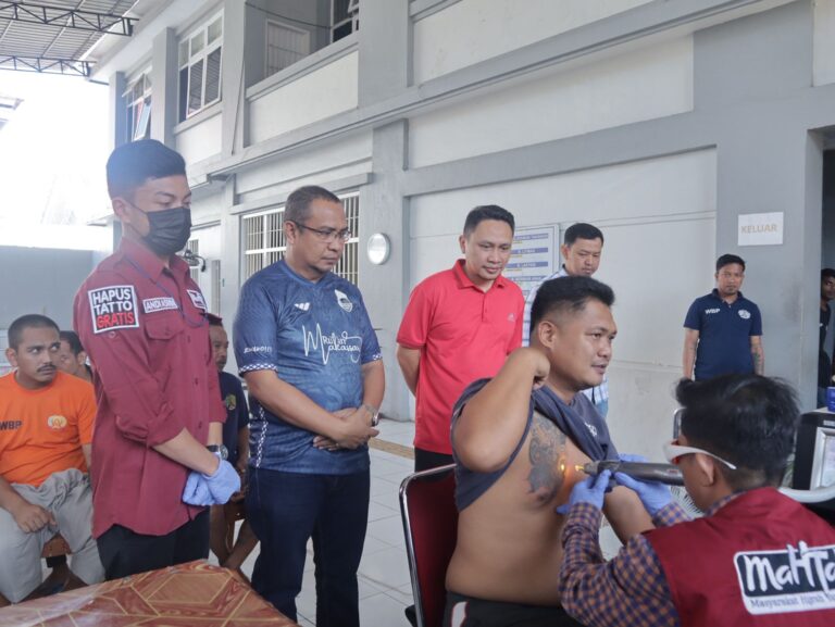 Langkah Kecil Menuju Perubahan Positif, Rutan Makassar Hadirkan Layanan Hapus Tato Gratis